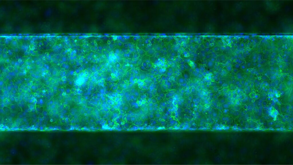 endothelial cells